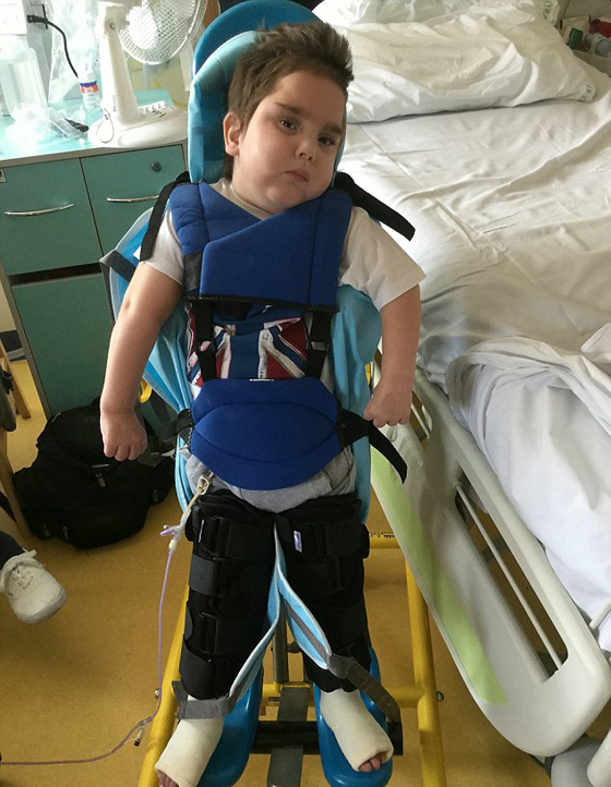 قطعة لحم تتسبب بتلف الدماغ والشلل التام لطفل بريطاني صورة رقم 2 قطعة لحم تتسبب بتلف الدماغ والشلل التام لطفل بريطاني صورة رقم 2