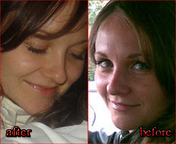 امرأة روسية تنتحر مع ابنها بسبب سخرية زوجها من انفها بعد التجميل! صورة رقم 1