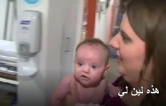 ولادة الطفلة (لين لي) للمرة الثانية بعد اصابتها بورم نادر صورة رقم 3