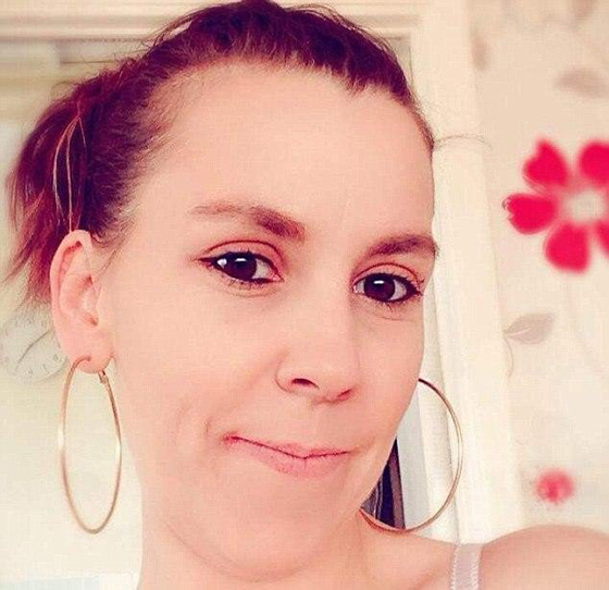 طلبت من حبيبها ان يغسل الصحون فحرق ظهرها بالمكواة!! صورة رقم 1