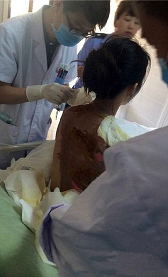 35 الف دولار تعويض لامراة سكب عليها نادل في مطعم ماء مغليا صورة رقم 3