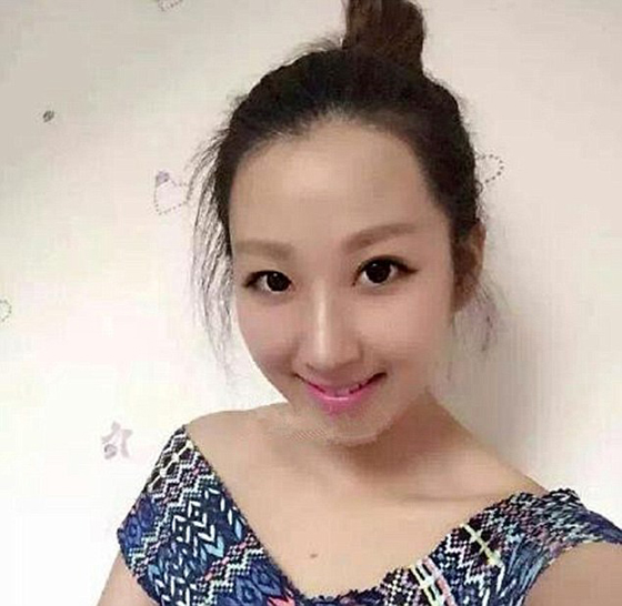 35 الف دولار تعويض لامراة سكب عليها نادل في مطعم ماء مغليا صورة رقم 1