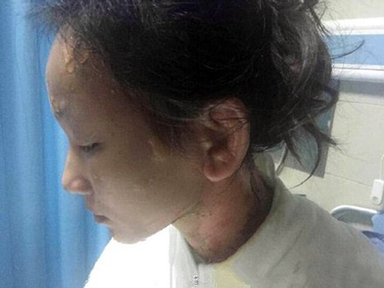 35 الف دولار تعويض لامراة سكب عليها نادل في مطعم ماء مغليا صورة رقم 4