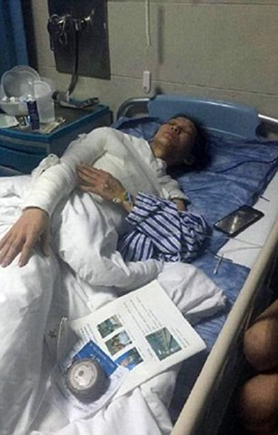 35 الف دولار تعويض لامراة سكب عليها نادل في مطعم ماء مغليا صورة رقم 5