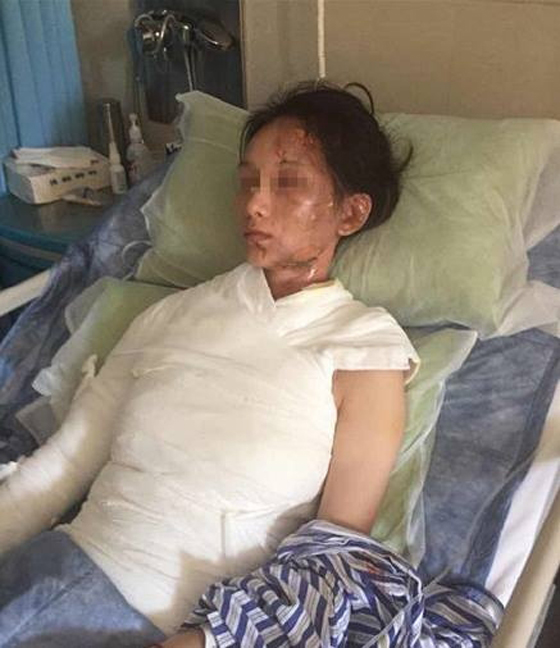 35 الف دولار تعويض لامراة سكب عليها نادل في مطعم ماء مغليا صورة رقم 2