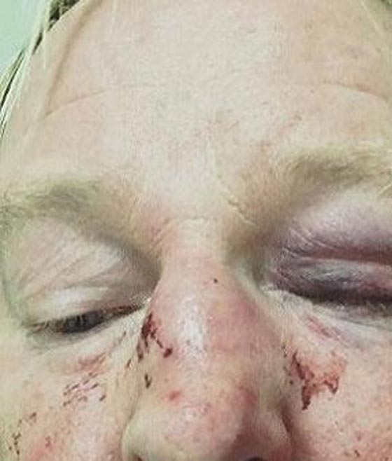 3 مسلمين يعتدون على كبير الطهاة في السويد لانه شبيه ترامب!  صورة رقم 1