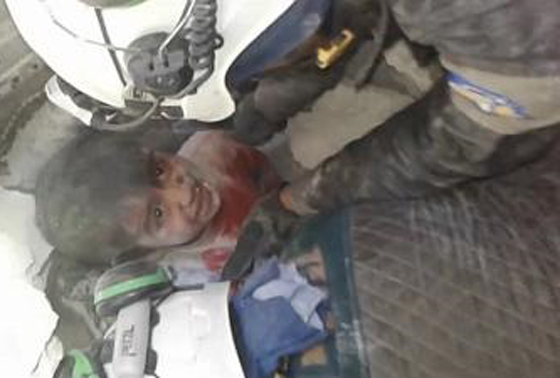 فيديو مؤثر لعملية انقاذ طفل سوري من تحت الانقاض شرقي حلب صورة رقم 1