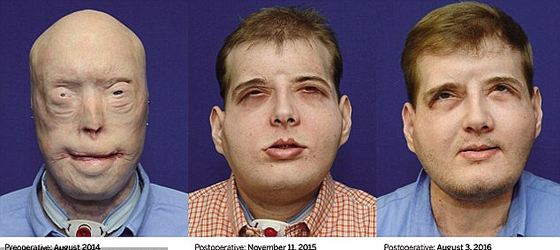 فيديو مؤثر للحظة التقاء ام بوجه ابنها المتوفى منذ نحو عام! صورة رقم 12