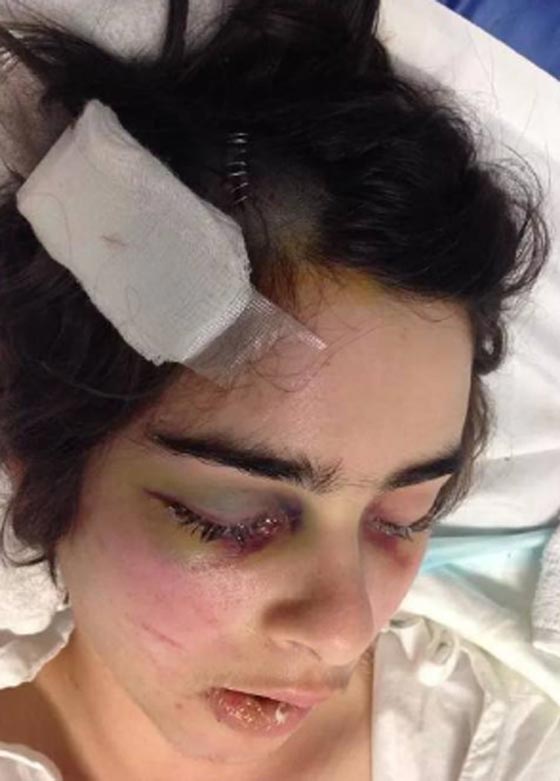 فيديو مثير.. صدم فتاة وتركها بين الحياة والموت  صورة رقم 3