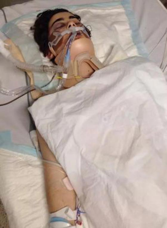 فيديو مثير.. صدم فتاة وتركها بين الحياة والموت  صورة رقم 2