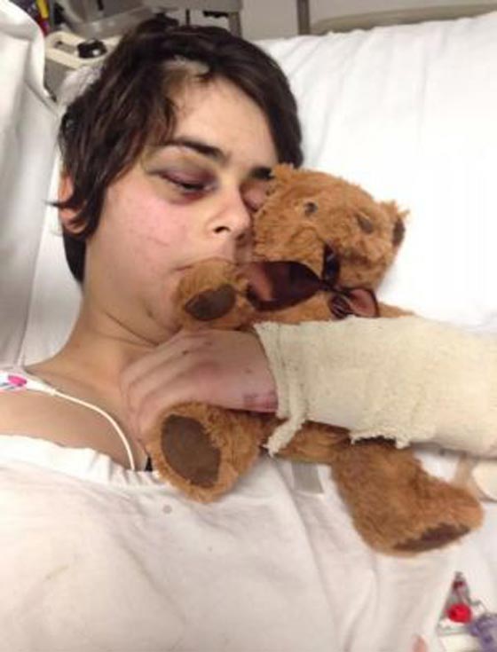 فيديو مثير.. صدم فتاة وتركها بين الحياة والموت  صورة رقم 1