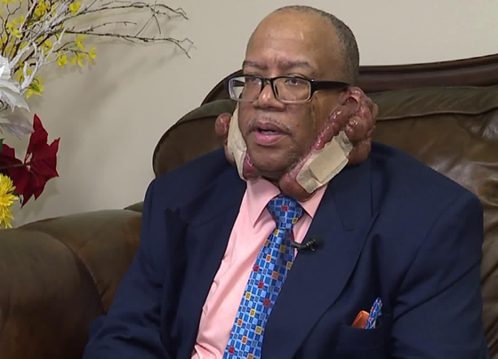  حلاق يتسبب في معاناة رجل لـمدة 12 عاما لم تنته بعد! صورة رقم 1