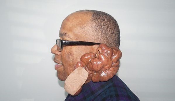  حلاق يتسبب في معاناة رجل لـمدة 12 عاما لم تنته بعد! صورة رقم 2