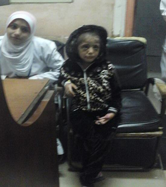 صور صادمة.. مصري يعذب ابنته بالنار لانها اكلت وجبة شقيقها! صورة رقم 1