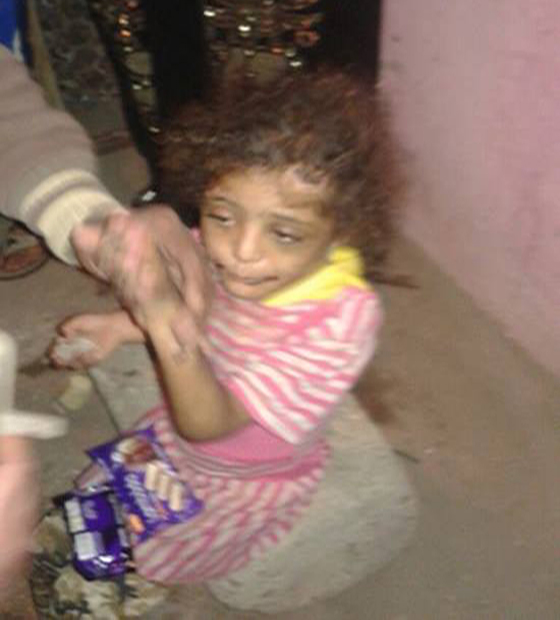 صور صادمة.. مصري يعذب ابنته بالنار لانها اكلت وجبة شقيقها! صورة رقم 3