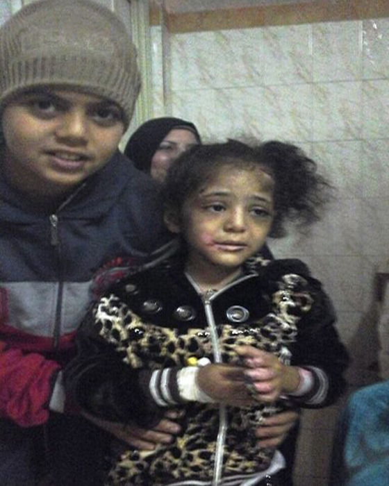 صور صادمة.. مصري يعذب ابنته بالنار لانها اكلت وجبة شقيقها! صورة رقم 4