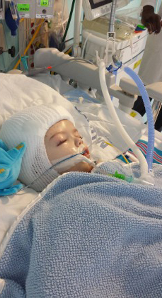 طفلان ملتصقان يرى الواحد منهما وجه توأمه لاول بعد فصلهما! فيديو صورة رقم 13