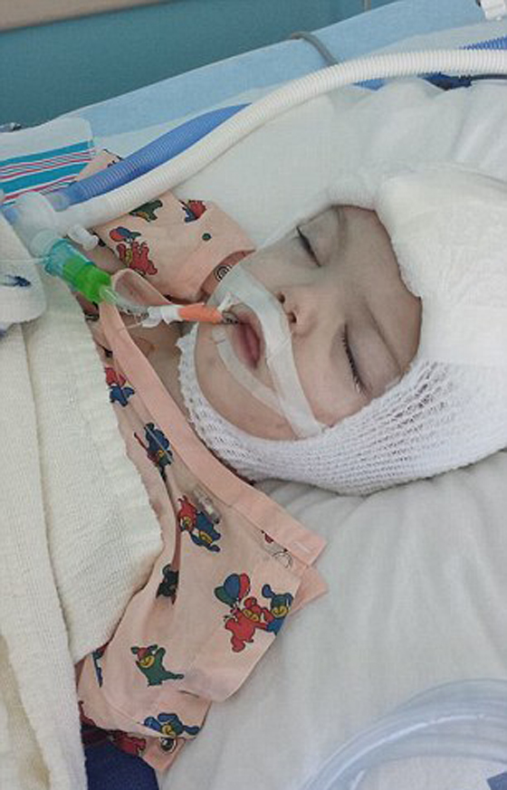 طفلان ملتصقان يرى الواحد منهما وجه توأمه لاول بعد فصلهما! فيديو صورة رقم 14