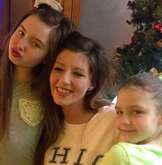 على فراش الموت.. شابة  تروي كيف سكب صديقها الوقود عليها واحرقها! صورة رقم 5