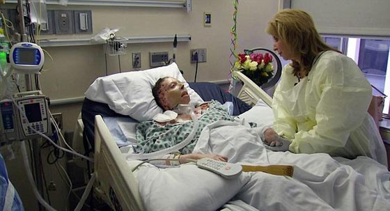 على فراش الموت.. شابة  تروي كيف سكب صديقها الوقود عليها واحرقها! صورة رقم 3