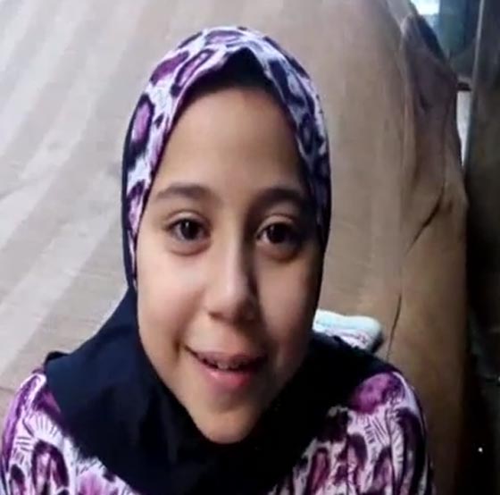  طالبة تتهم معلمة بإطفاء عود كبريت بيدها: ضربتني بالخرطوم على الحرق صورة رقم 2