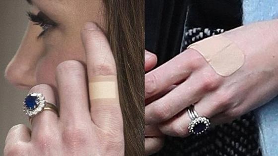 ماذا تخفي الاميرة كيت ميدلتون تحت لاصقات الجروح على يديها؟ صور صورة رقم 3