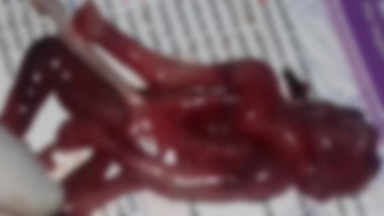 امرأة مصرية تجهض حملها بسبب تشوه الجنين فيتضح انه قرد صورة رقم 2