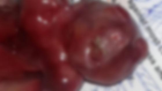 امرأة مصرية تجهض حملها بسبب تشوه الجنين فيتضح انه قرد صورة رقم 1