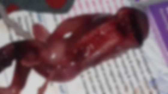 امرأة مصرية تجهض حملها بسبب تشوه الجنين فيتضح انه قرد صورة رقم 3