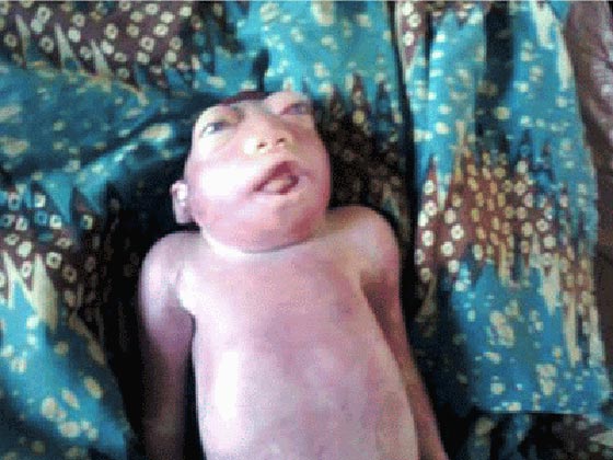 امرأة مصرية تجهض حملها بسبب تشوه الجنين فيتضح انه قرد صورة رقم 4