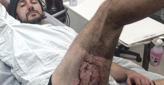 الى عشاق الايفون فقط.. احذروا انفجاره في جيوبكم صورة رقم 1 الى عشاق الايفون فقط.. احذروا انفجاره في جيوبكم صورة رقم 1