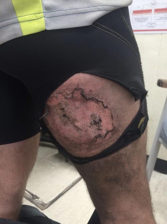 الى عشاق الايفون فقط.. احذروا انفجاره في جيوبكم صورة رقم 4 الى عشاق الايفون فقط.. احذروا انفجاره في جيوبكم صورة رقم 4