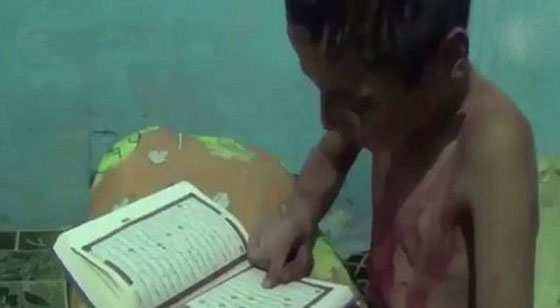 صورة طفل سوري يقرأ القرآن وهو يبكي وينزف ينتظر القصف! صورة رقم 2