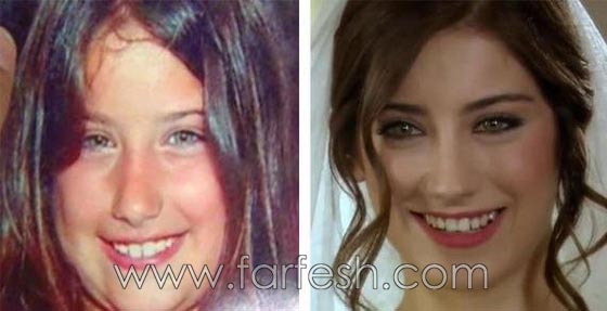 صور فنانين في الطفولة وصورهم الآن.. لن تصدّق الفروق! صورة رقم 6