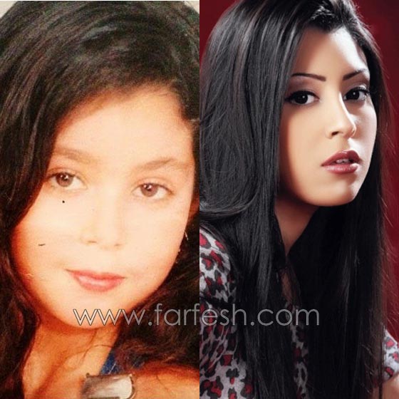 صور فنانين في الطفولة وصورهم الآن.. لن تصدّق الفروق! صورة رقم 10