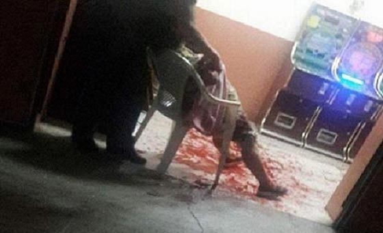 فيديو مروع.. رجل غاضب يقطع يد امرأة بساطور في كازينو صورة رقم 1