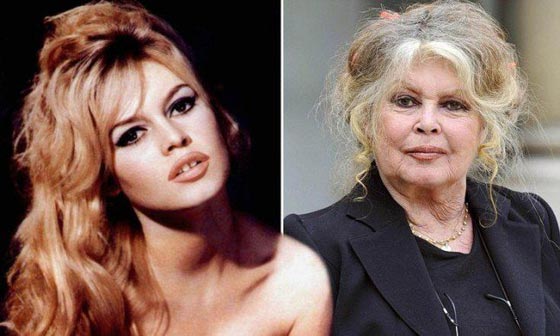 صور صادمة لنجمات الزمن الجميل.. في الزمن العليل صورة رقم 8