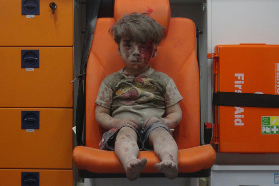 حلب: الطفل عمران يتحدث باسم وطنه السوري الجريح صورة رقم 1