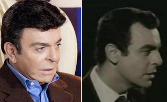صور نادرة لنجوم عالميين بدون باروكات.. شاهد اشكالهم الحقيقية صورة رقم 1