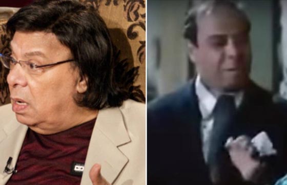 صور نادرة لنجوم عالميين بدون باروكات.. شاهد اشكالهم الحقيقية صورة رقم 4