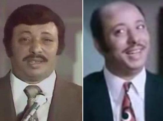 صور نادرة لنجوم عالميين بدون باروكات.. شاهد اشكالهم الحقيقية صورة رقم 3