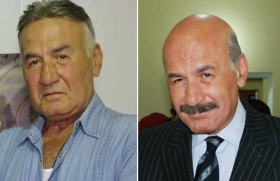 صور نادرة لنجوم عالميين بدون باروكات.. شاهد اشكالهم الحقيقية صورة رقم 2