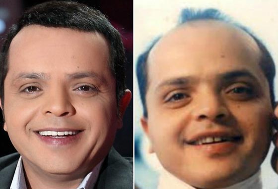 صور نادرة لنجوم عالميين بدون باروكات.. شاهد اشكالهم الحقيقية صورة رقم 11