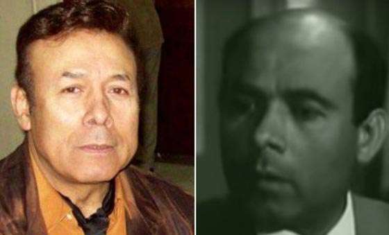 صور نادرة لنجوم عالميين بدون باروكات.. شاهد اشكالهم الحقيقية صورة رقم 13