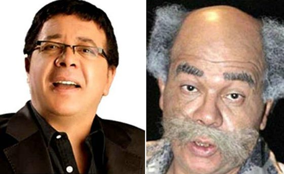 صور نادرة لنجوم عالميين بدون باروكات.. شاهد اشكالهم الحقيقية صورة رقم 14
