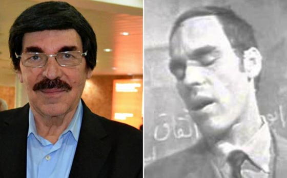 صور نادرة لنجوم عالميين بدون باروكات.. شاهد اشكالهم الحقيقية صورة رقم 18