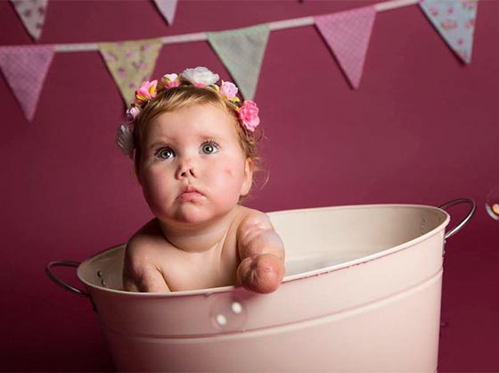 طفلة مبتورة الاطراف تفاجئ امها ببتر اطراف لعبتها.. شاهدها صورة رقم 8