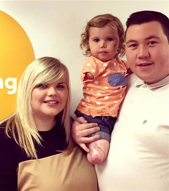 طفلة مبتورة الاطراف تفاجئ امها ببتر اطراف لعبتها.. شاهدها صورة رقم 10