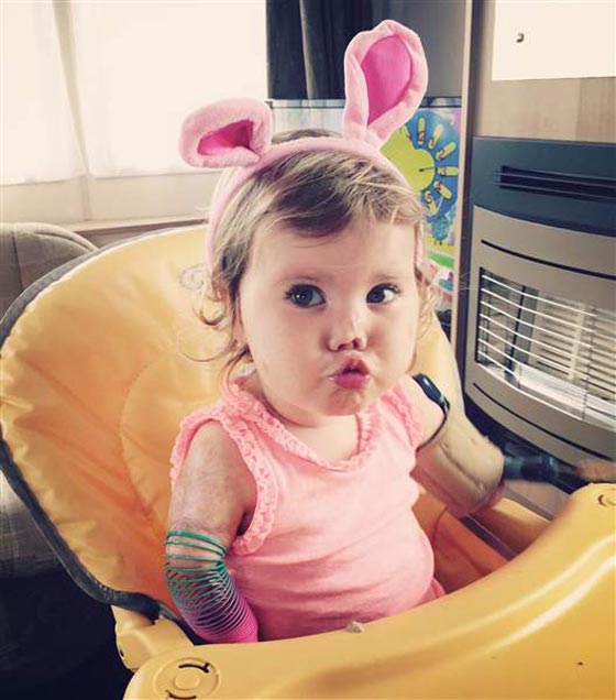 طفلة مبتورة الاطراف تفاجئ امها ببتر اطراف لعبتها.. شاهدها صورة رقم 7