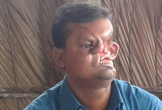 رجل يكشف عن وجهه المشوّه من جراء هجوم نمر عليه قبل 20 عاما صورة رقم 2